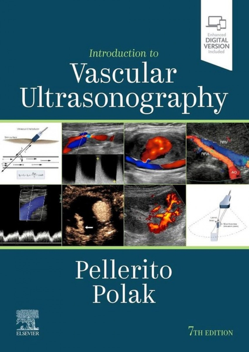 Introduction to vascular ultrasonography