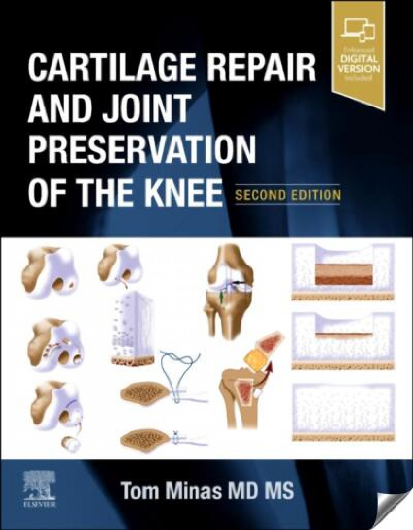 Portada de Cartilage repais and joint preservation of the knee
