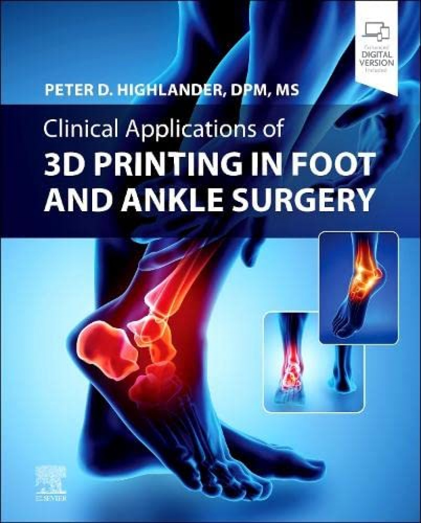3D Printing in Foot and Ankle Surgery