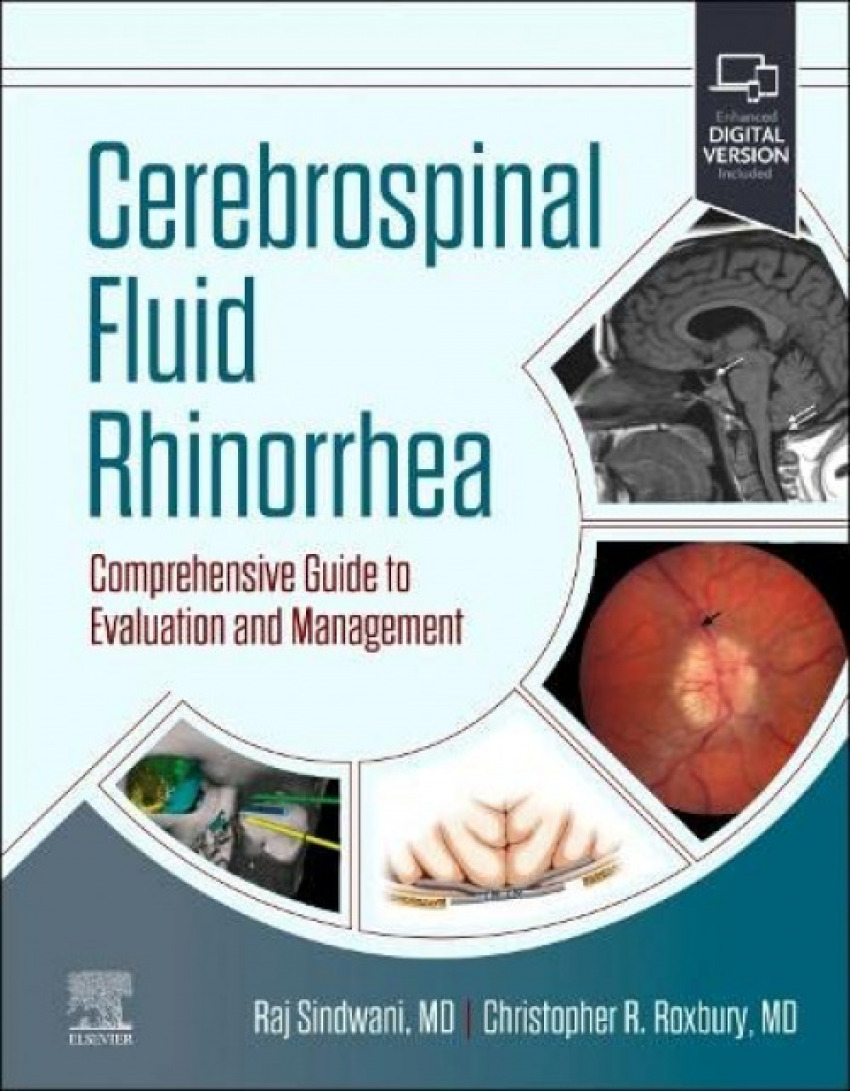 Portada de Cerebrospinal fluid rhinorrhea