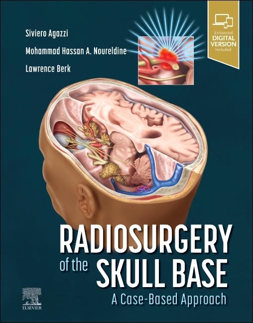 Radiosurgery of the skull base:a case based approach