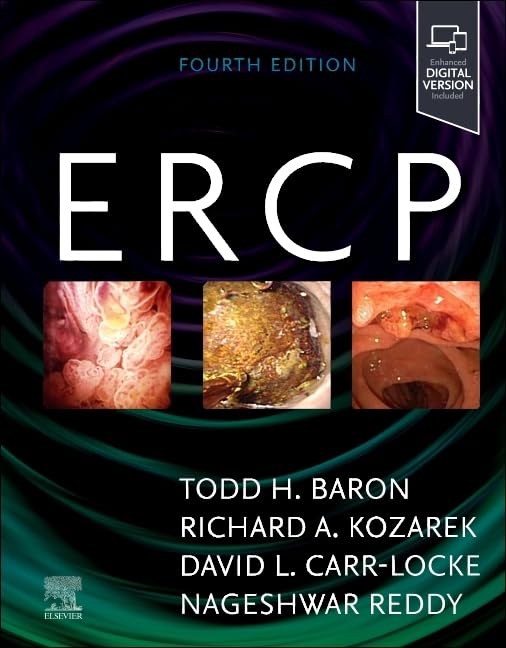 Ercp