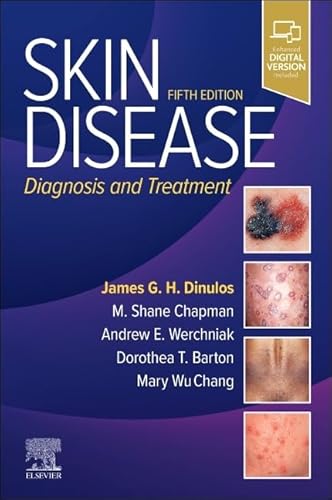 Skin disease:diagnosis and treatment