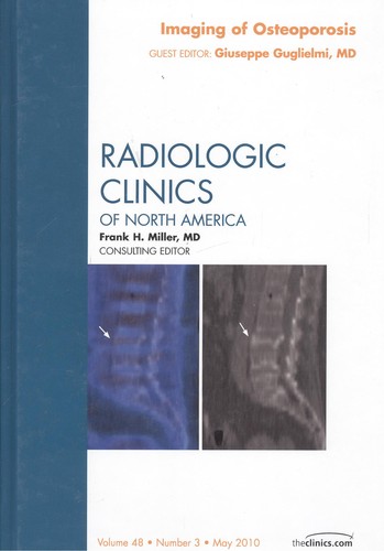 Imaging of osteoporosis radiologic clinics of north america volume 48