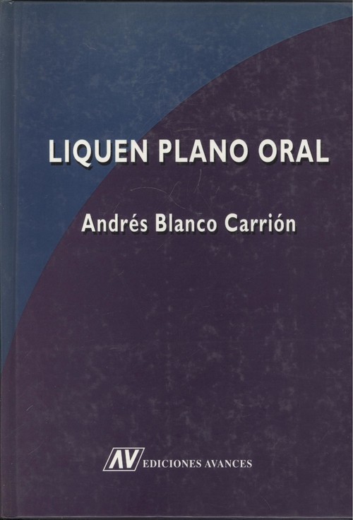 Liquen plano oral