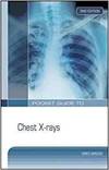 POCKET GUIDE TO CHEST X-RAYS