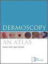 DERMOSCOPY: AN ATLAS