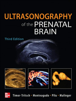 ULTRASONOGRAPHY OF THE PRENATAL AND NEONATAL BRAIN