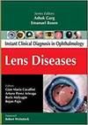 LENS DISEASE