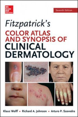 FITZPATRICK'S COLOR ATLAS AND SYNOPSIS OF CLINICAL DERMATOLOGY