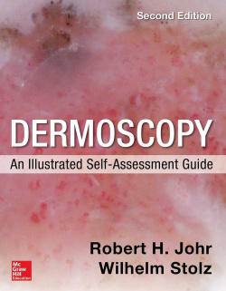 Dermoscopy: an illustrated self-assessment guide