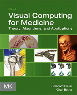 Visual Computing for Medicine