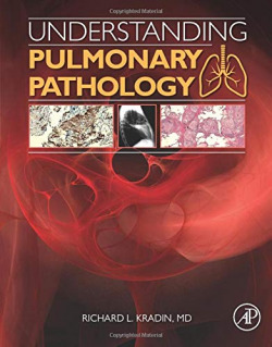 Understanding Pulmonary Pathology