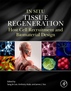 In Situ Tissue Regeneration