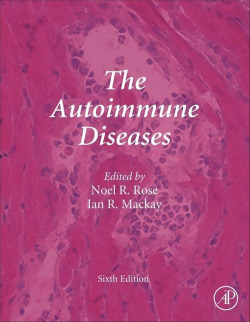 The autoimmune diseases
