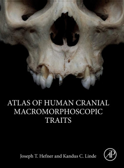 ATLAS OF HUMAN CRANIAL MACROMORPHOSCOPIC TRAITS