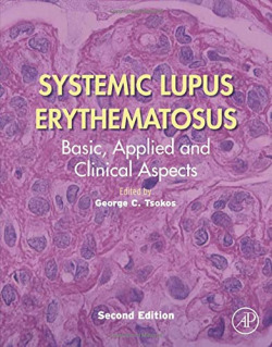 SYSTEMIC LUPUS ERYTHEMATOSUS