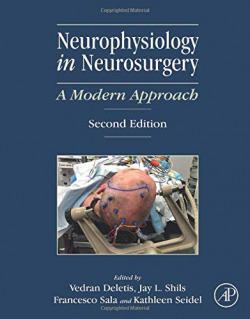 NEUROPHYSIOLOGY IN NEUROSURGERY