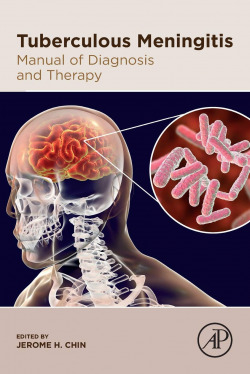 TUBERCULOUS MENINGITIS