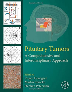 PITUITARY TUMORS