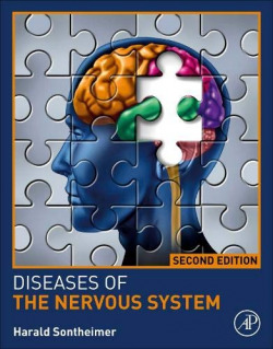 DISEASES OF DE NERVOUS SYSTEM 2ND.EDITION