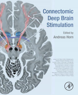 Connectomic deep brain stimulation