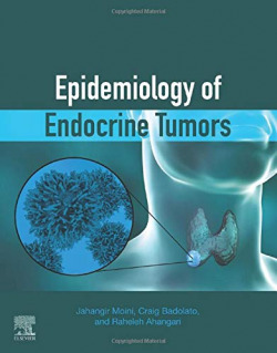 EPIDEMIOLOGY OF ENDOCRINE TUMORS