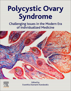 Polycystic ovary syndrome:challenging issues in the modern
