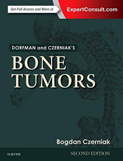 Dorfman and Czerniak's Bone Tumors
