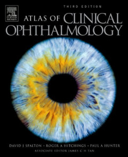 Atlas of Clinical Ophthalmology With CD-ROM