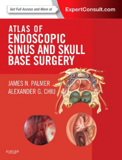 Atlas of Endoscopic Sinus and Skull Base Surgery