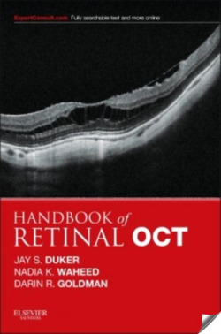 Handbook of Retinal OCT: Optical Coherence Tomography