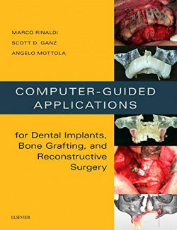 Computer-Guided Applications for Dental Implants, Bone Grafting, and Reconstructive Surgery (adapted