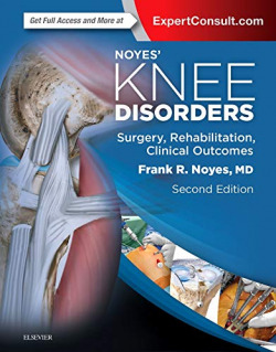 Noyes' Knee Disorders: Surgery, Rehabilitation, Clinical Outcomes
