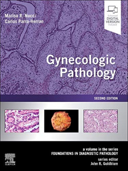 Gynecology pathology