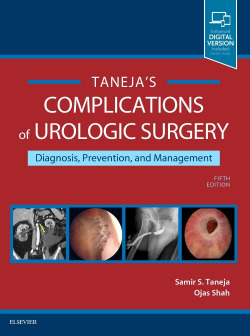 COMPLICATIONS OF UROLOGIC SURGERY.(PREVENTION AND MANAGEMENT.(5TH EDITION)