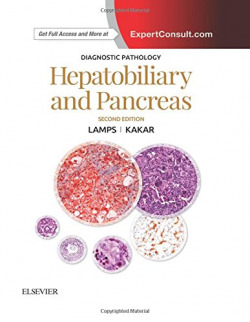 Diagnostic Pathology: Hepatobiliary and Pancreas
