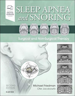 SLEEP APNEA AND SNORING