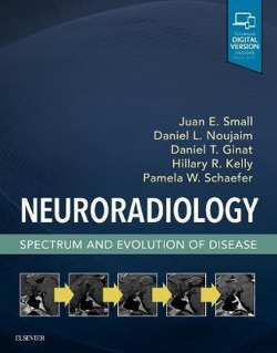 NEURORADIOLOGY, SPECTRUM AND EVOLUTION OF DISEASE