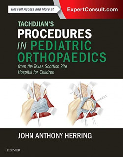 TACHDJIAN'S PROCEDURES IN PEDIATRIC ORTHOPAEDICS.(FROM THE TEXAS SCOTTISH RITE HOSPITAL FOR CHILDREN