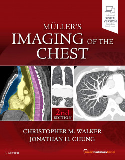 MULLER´S IMAGING OF THE CHEST
