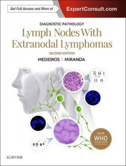 DIAGNOSTIC PATHOLOGY: LYMPH NODES AND EXTRANODAL LYMPHOMAS.(2ND EDITION)
