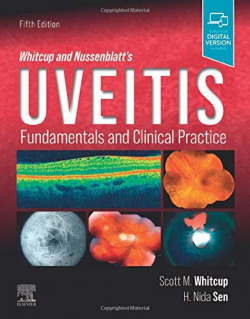 Whitcup and nussenblatt´s uveitis