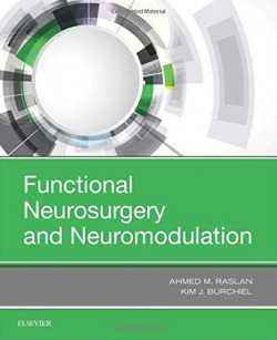 Functional neurosurgery and neuromodulation