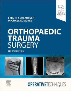 OPERATIVE TECHNIQUES ORTHOPAEDIC TARUMA SURGERY