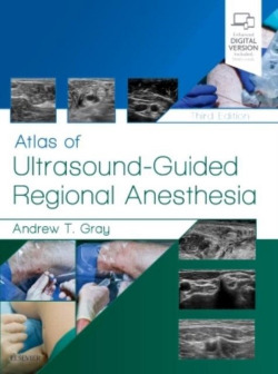 ATLAS OF ULTRASOUND-GUIDED REGIONAL ANESTHESIA.(3RD EDITION)