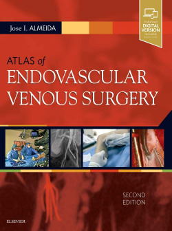 ATLAS OF ENDOVASCULAR VENOUS SURGERY