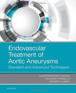 Endovascular treatment of aortic aneurysms