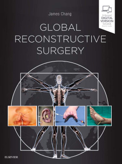 Global reconstructive surgery