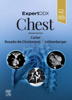 Expertddx:chest